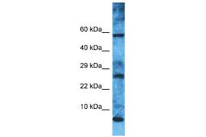 Western Blotting (WB) image for anti-Mitochondrial Ribosomal Protein L52 (MRPL52) (N-Term) antibody (ABIN2446126) (MRPL52 anticorps  (N-Term))