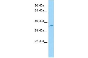 Host: Rabbit Target Name: Glt1d1 Sample Type: Rat Pancreas lysates Antibody Dilution: 1. (GLT1D1 anticorps  (N-Term))