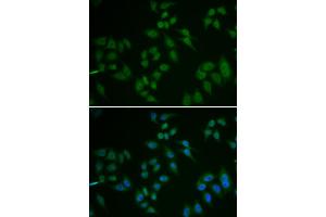 Immunofluorescence analysis of U2OS cells using TP63 antibody. (TCP1 alpha/CCTA anticorps)
