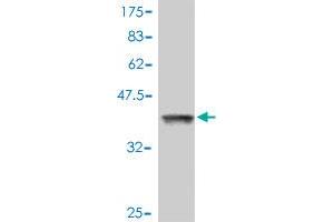 Western Blot detection against Immunogen (37. (RHOA anticorps  (AA 91-190))