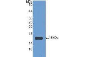 Detection of Recombinant IL4, Gallus using Polyclonal Antibody to Interleukin 4 (IL4) (IL-4 anticorps  (AA 26-136))