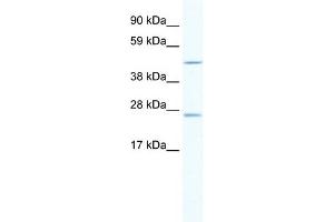 WB Suggested Anti-ANXA11 Antibody Titration:  2. (Annexin A11 anticorps  (C-Term))