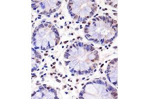 IHC-P analysis of human colon tissue. (PELP1 anticorps)