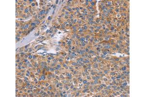 Immunohistochemistry (IHC) image for anti-Cell Division Cycle 7 (CDC7) antibody (ABIN2432826) (CDC7 anticorps)