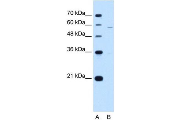 PIGV anticorps  (N-Term)