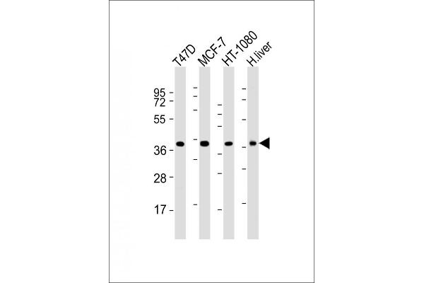 ACBD4 anticorps  (AA 168-198)