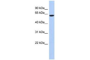 CAMKV antibody used at 1 ug/ml to detect target protein. (CAMKV anticorps  (N-Term))