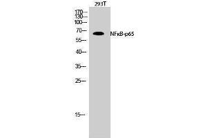 Western Blotting (WB) image for anti-Nuclear Factor-kB p65 (NFkBP65) (Thr735) antibody (ABIN3176329) (NF-kB p65 anticorps  (Thr735))