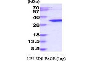 SDS-PAGE (SDS) image for Cyclin-Dependent Kinase 5 (CDK5) (AA 1-292) protein (His tag) (ABIN5855017) (CDK5 Protein (AA 1-292) (His tag))