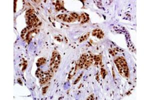 Immunohistochemistry (IHC) image for anti-Melanoma Antigen Family A, 4 (MAGEA4) antibody (ABIN3002532) (MAGEA4 anticorps)