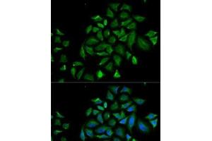 Immunofluorescence analysis of HeLa cells using FGFR1 Polyclonal Antibody (FGFR1 anticorps)