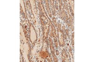 Immunohistochemistry (Paraffin-embedded Sections) (IHC (p)) image for anti-Wingless-Type MMTV Integration Site Family, Member 5A (WNT5A) (AA 185-213) antibody (ABIN651869)