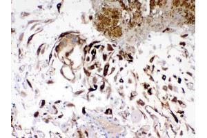 IHC analysis of IGFBP1 using anti- IGFBP1 antibody . (IGFBPI anticorps  (AA 69-259))