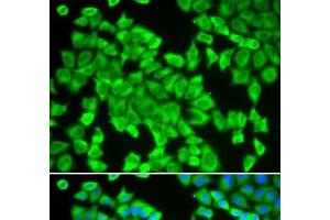 Immunofluorescence analysis of HeLa cells using STIP1 Polyclonal Antibody (STIP1 anticorps)