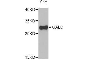 Western Blotting (WB) image for anti-Galactosylceramidase (GALC) (AA 40-300) antibody (ABIN6220405) (GALC anticorps  (AA 40-300))