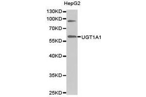 Western Blotting (WB) image for anti-UDP Glucuronosyltransferase 1 Family, Polypeptide A1 (UGT1A1) antibody (ABIN1875274) (UGT1A1 anticorps)