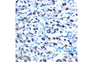 Immunohistochemistry of paraffin-embedded rat stomach using DMT1 Rabbit pAb (ABIN6129471, ABIN6147839, ABIN6147840 and ABIN6214400) at dilution of 1:100 (40x lens). (SLC11A2 anticorps  (AA 1-100))