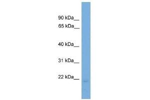 Western Blot showing EDN2 antibody used at a concentration of 1-2 ug/ml to detect its target protein. (Endothelin 2 anticorps  (N-Term))