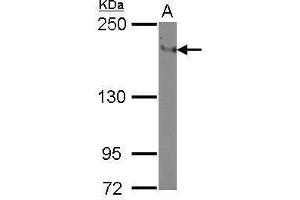 WB Image Sample (30 ug of whole cell lysate) A: THP-1 5% SDS PAGE antibody diluted at 1:500 (ITGAL anticorps  (Center))