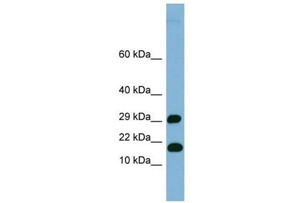 TRAPPC2L anticorps  (N-Term)