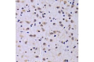 Immunohistochemistry of paraffin-embedded rat brain using NUDC antibody. (NUDC anticorps  (AA 1-331))