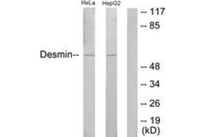 Western Blotting (WB) image for anti-Desmin (DES) (AA 26-75) antibody (ABIN2888927) (Desmin anticorps  (AA 26-75))