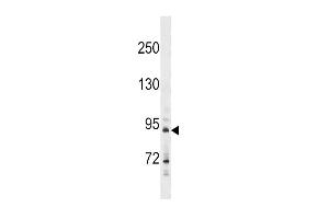 Western blot analysis in A549 cell line lysates (35ug/lane). (HHIP anticorps  (N-Term))