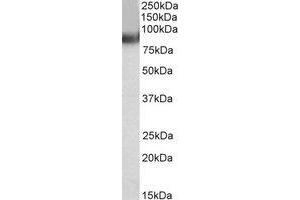 Western Blotting (WB) image for anti-Tripartite Motif Containing 63 (TRIM63) (C-Term) antibody (ABIN2465973) (TRIM63 anticorps  (C-Term))