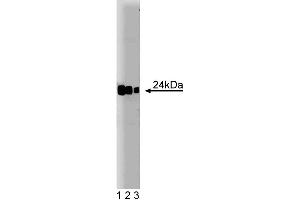 Western blot analysis of Rab8 on a Jurkat cell lysate. (RAB8A anticorps  (AA 84-205))