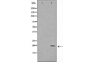 Western blot analysis on HepG2 cell lysate using KAD6 Antibody，The lane on the left is treated with the antigen-specific peptide. (TAF9 anticorps  (Internal Region))