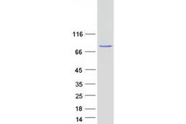 PKC beta Protein (Transcript Variant 1) (Myc-DYKDDDDK Tag)