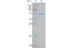 Human -Nanodisc, Flag Tag on SDS-PAGE (GPR77 Protéine)