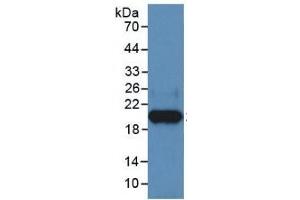 Western Blotting (WB) image for Heparanase (HPSE) ELISA Kit (ABIN6574194)