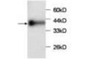 Image no. 1 for anti-Chemokine (C-C Motif) Ligand 2 (CCL2) antibody (ABIN791500) (CCL2 anticorps)