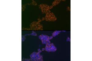 Immunofluorescence analysis of Jurkat cells using CD3G Rabbit mAb (ABIN1682574, ABIN3018517, ABIN3018518 and ABIN7101622) at dilution of 1:100 (40x lens). (CD3G anticorps)