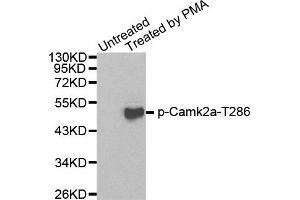 Western Blotting (WB) image for anti-Calcium/calmodulin-Dependent Protein Kinase II alpha (CAMK2A) (pThr286) antibody (ABIN1870029) (CAMK2A anticorps  (pThr286))