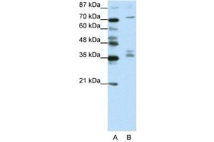 WB Suggested Anti-AKAP9  Antibody Titration: 1. (AKAP9 anticorps  (N-Term))
