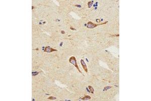 Immunohistochemistry (Paraffin-embedded Sections) (IHC (p)) image for anti-Cannabinoid Receptor 2 (CNR2) (AA 329-356), (C-Term) antibody (ABIN654631)