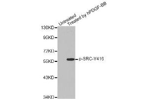 Western blot analysis of extracts from COLO205 cells, using Phospho-SRC-Y418 antibody (ABIN5969963). (Src anticorps  (pTyr418))