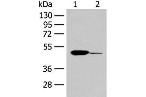 Western blot analysis of Mouse heart tissue and K562 cell lysates using ACOD1 Polyclonal Antibody at dilution of 1:400 (IRG1 anticorps)