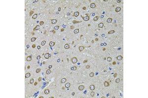 Immunohistochemistry of paraffin-embedded rat brain using EIF4A2 antibody (ABIN5972034) at dilution of 1/100 (40x lens). (EIF4A2 anticorps)