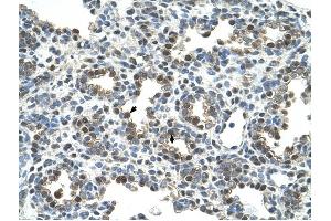 Glycoprotein antibody was used for immunohistochemistry at a concentration of 4-8 ug/ml to stain Alveolar cells (arrows) in Human Lung. (Glycoprotein anticorps)