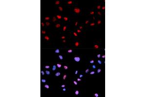 Immunofluorescence analysis of MCF-7 cells using Phospho-CDK1-T161 antibody (ABIN5969957). (CDK1 anticorps  (pThr161))