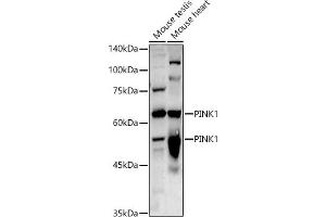 Western blot analysis of extracts of various cell lines, using PINK1 antibody (ABIN6128457, ABIN6145665, ABIN6145667 and ABIN6215214) at 1:1000 dilution. (PINK1 anticorps  (AA 282-581))