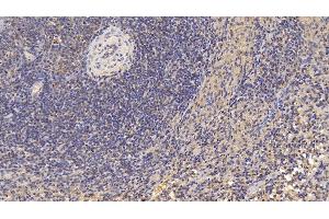 Detection of CD3d in Human Spleen Tissue using Monoclonal Antibody to Cluster Of Differentiation 3d (CD3d) (CD3D anticorps  (AA 18-113))