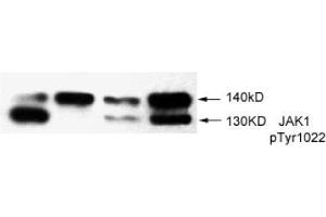 Image no. 2 for anti-Janus Kinase 1 (JAK1) (pTyr1022) antibody (ABIN196869) (JAK1 anticorps  (pTyr1022))