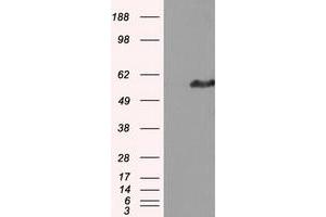 HEK293T cells were transfected with the pCMV6-ENTRY control (Left lane) or pCMV6-ENTRY IFT57 (Right lane) cDNA for 48 hrs and lysed. (IFT57 anticorps)