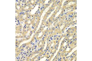 Immunohistochemistry of paraffin-embedded mouse kidney using WIPI2 antibody (ABIN5975599) at dilution of 1/100 (40x lens). (WIPI2 anticorps)