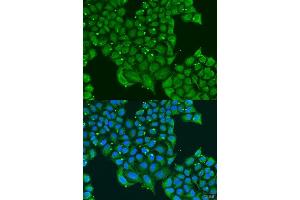 Immunofluorescence analysis of U2OS cells using ATPIF1 antibody. (ATPase Inhibitory Factor 1 anticorps  (AA 26-106))