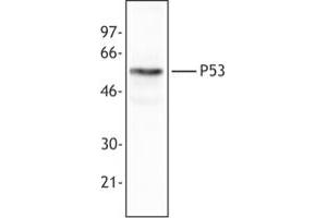 Image no. 1 for anti-Tumor Protein P53 (TP53) (AA 20-25) antibody (ABIN205508) (p53 anticorps  (AA 20-25))